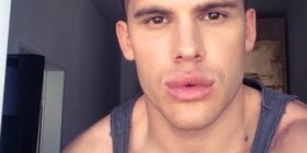 ken rodeo pumped lips