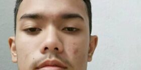 tekakgatal armpit94 btg terbaik fuhhhh