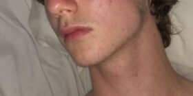 whats your opinion on trent also he exploded on