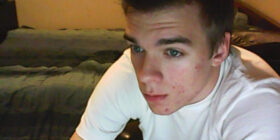 hope you acne clears up sweetie youd be perfect